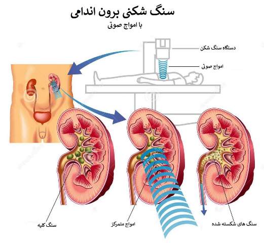 دستگاه