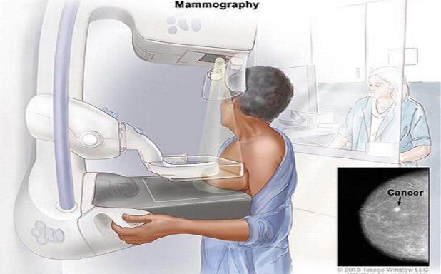ماموگرافی
